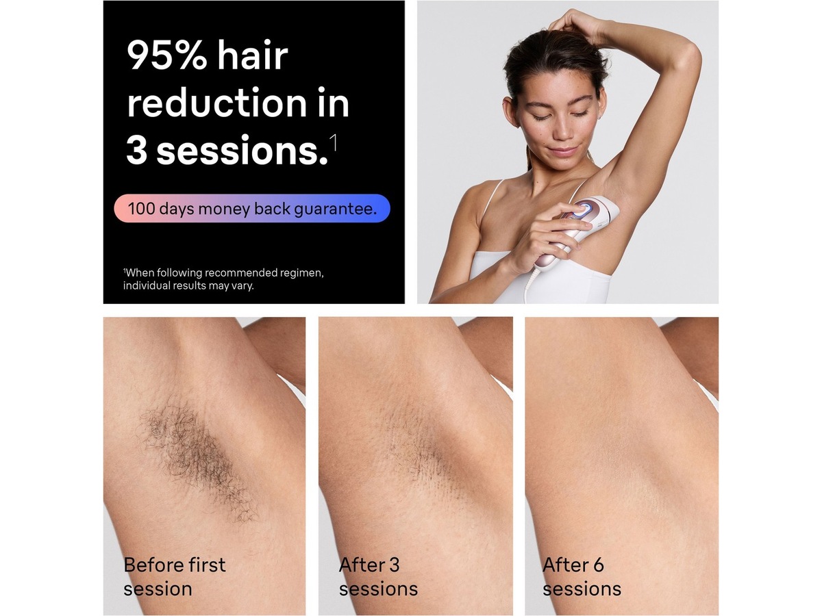 Braun IPL Skin i·expert PL7431 Epilator & IPL-hårborttagning