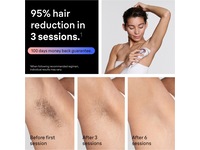 Braun IPL Skin i·expert PL7431 Epilator & IPL-hårborttagning